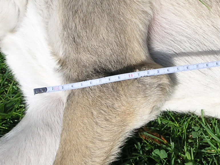 Hygroma on left elbow 02.jpg